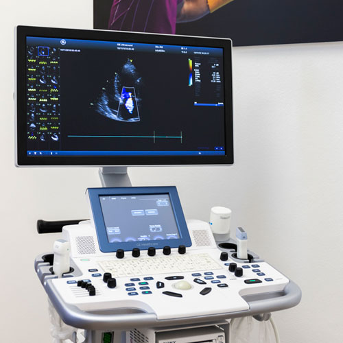 Eco color doppler cardiaco a Ispra Varese